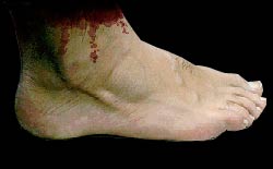 Bloody foot
