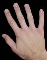 Bloody hand