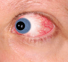 Moving eye ball